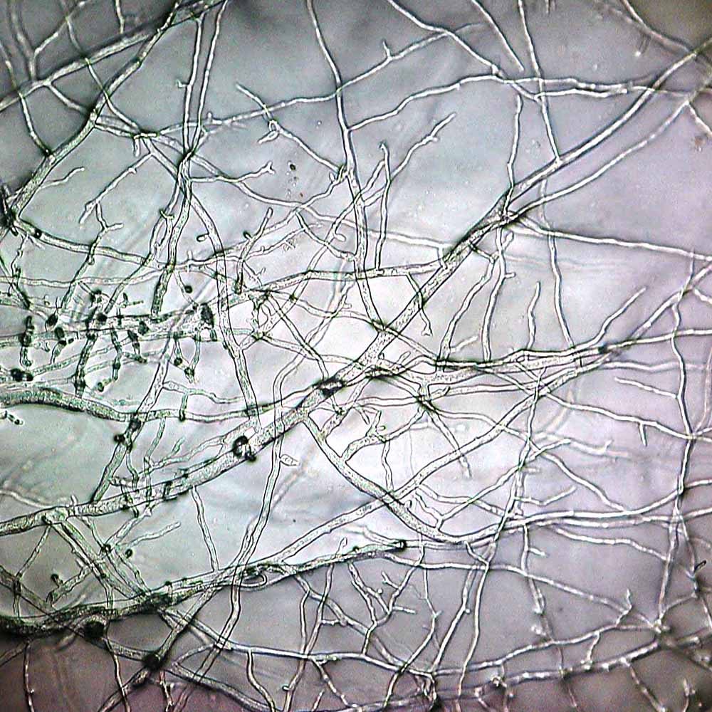 A close-up of mold growth on a sample